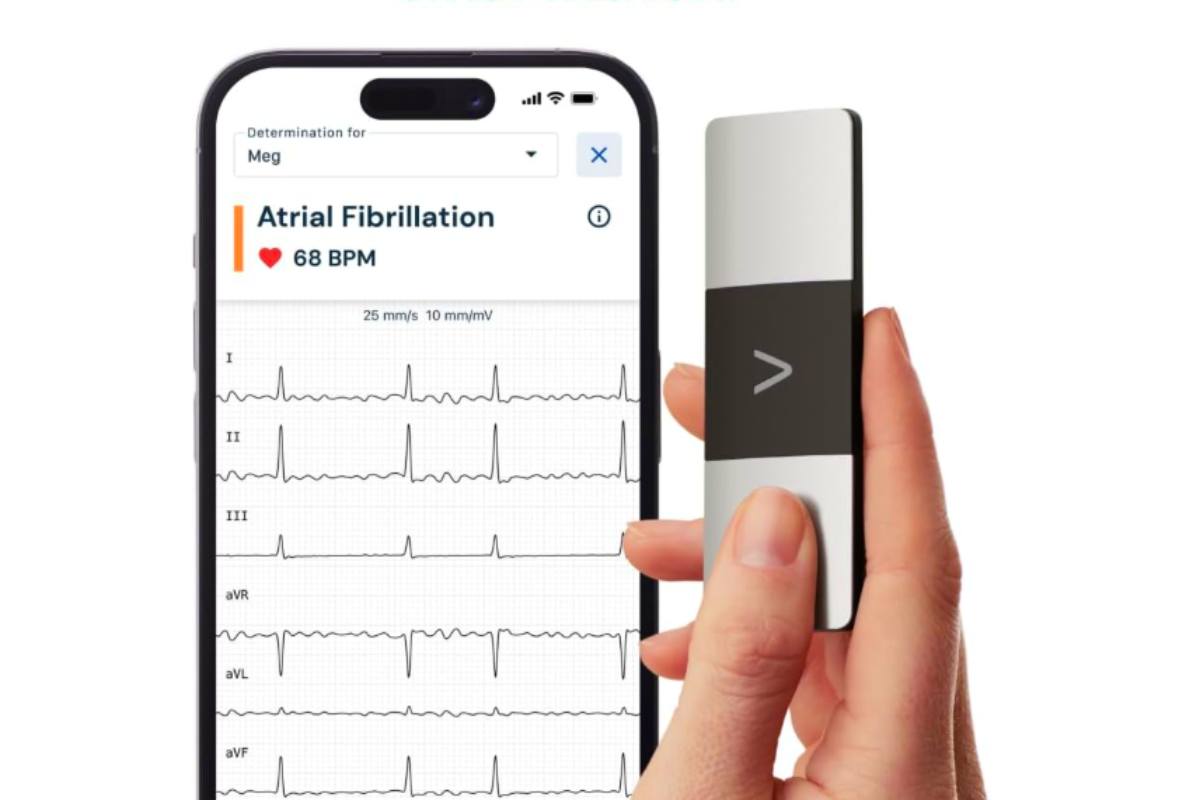 Macchina ECG wireless